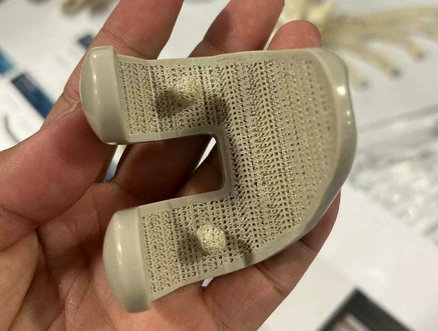 Implantes PEEK de grado médico impresos en 3D
