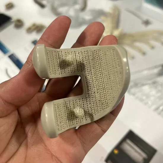 Implantes PEEK de grado médico impresos en 3D
