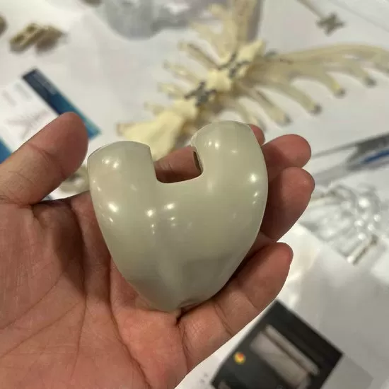 Implantes PEEK de grado médico impresos en 3D