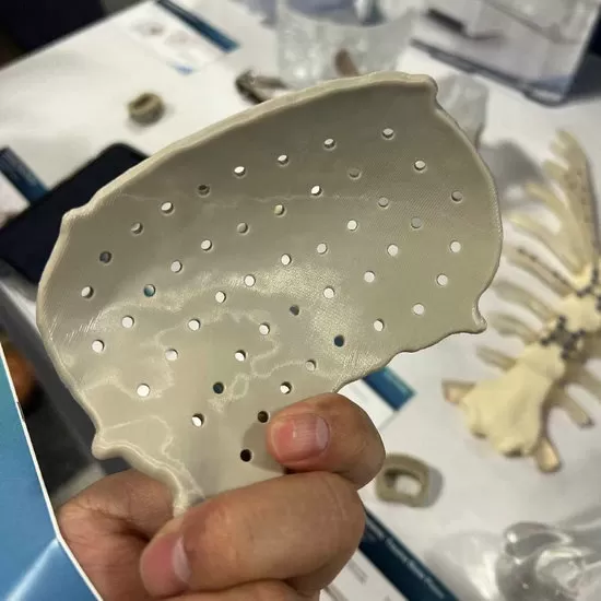 Implantes PEEK de grado médico impresos en 3D