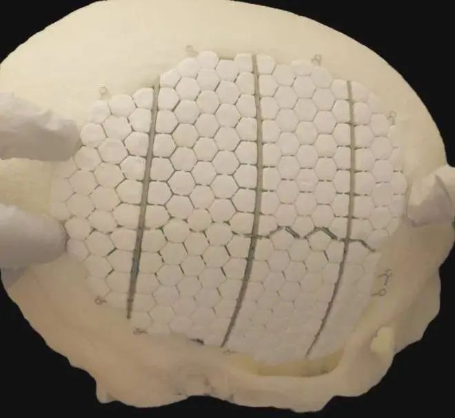 PEEK - Material avanzado para cranioplastia