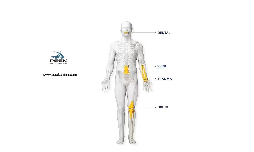 Aplicación del material PEEK en la industria de dispositivos médicos