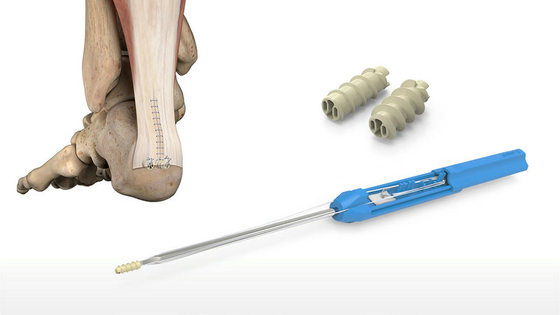 Descubra los beneficios de utilizar PEEK en dispositivos médicos